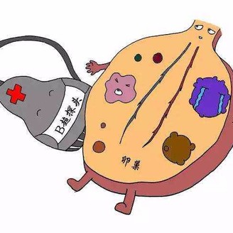 子宫腺肌症是怎么得的 病因有哪些