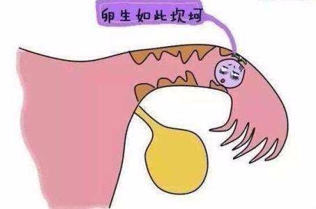 输卵管堵塞怎么导致 病因有哪些