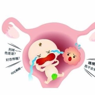 子宫肌瘤多大要手术 多大算是严重