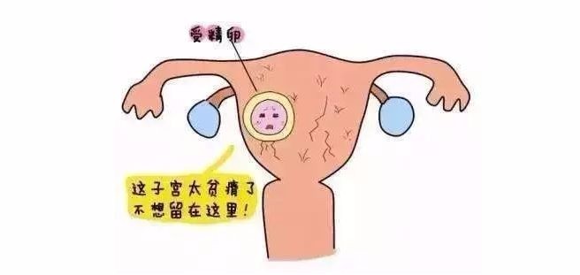 子宫囊肿是怎么形成的 子宫肌瘤和子宫囊肿的区别