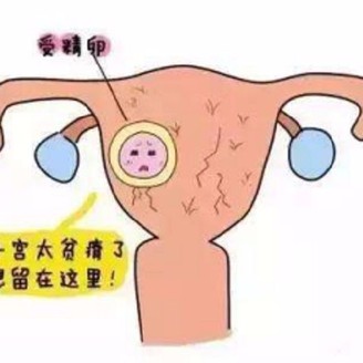 子宫畸形的类型 子宫畸形都有哪些常识