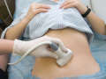 子宫畸形不孕 子宫畸形的不孕要怎样治疗