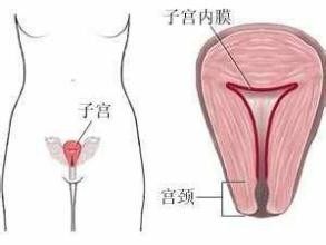 试管婴儿提高卵巢癌的概率吗  试管婴儿移植后着床失败的原因