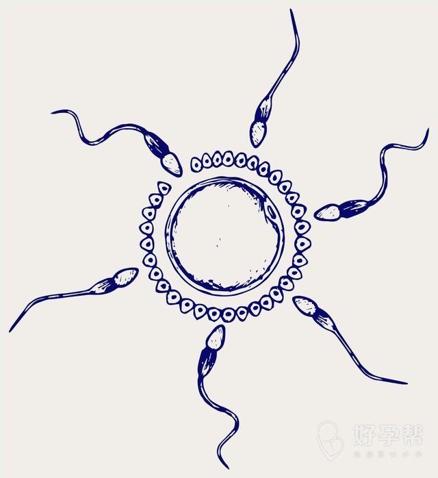 人工授精的注意事项有哪些？