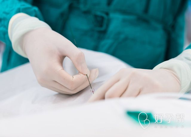 自然流产的三种特殊情况，你了解吗？