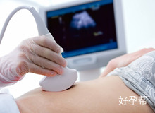 郭丽娜教授: 促排卵药物和方案要如何选择?