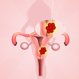 试管婴儿要选择私立医院吗？排行榜有哪些排行依据？