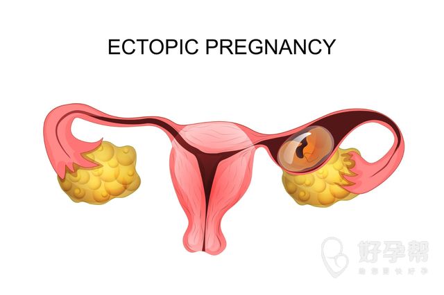 死精子能做试管婴儿？这是真的吗？