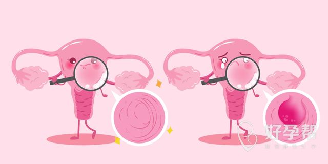 宫腹腔镜手术怀孕几率高吗？怀孕几率有多少？