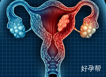 腹腔镜手术在哪做好?选择北京家圆医院