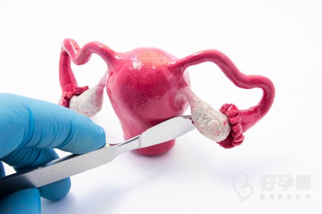 腹腔镜手术需要多少钱？贵不贵？