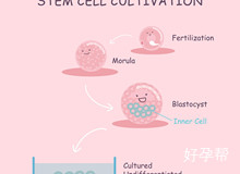 刘湘源胎停全套费用是多少？价格贵不贵？