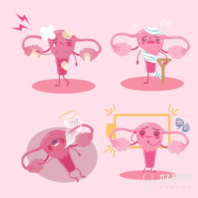 输卵管粘连严重怎么治？什么治疗方法最好？