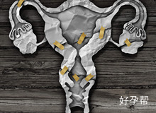 两侧输卵管远端粘连要做哪些检查?如何治疗?
