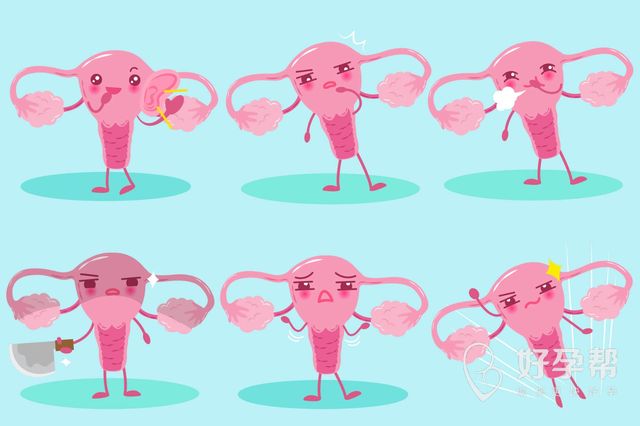 输卵管积水可以自愈吗？输卵管积水怎么办？