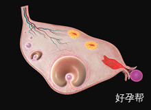 子宫内膜增生早期症状是什么？为什么会出现子宫内膜增生？