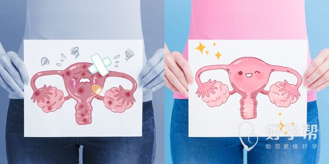 子宫内膜壁薄怎么办？子宫内膜壁薄应该如何治疗？