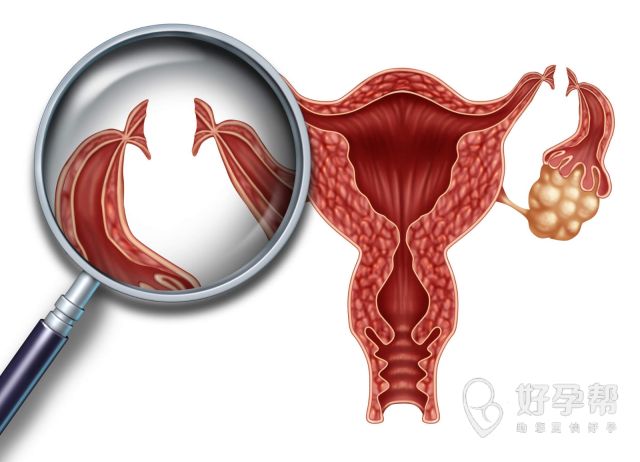 子宫内膜增生症状表现有哪些？这个疾病严重吗？