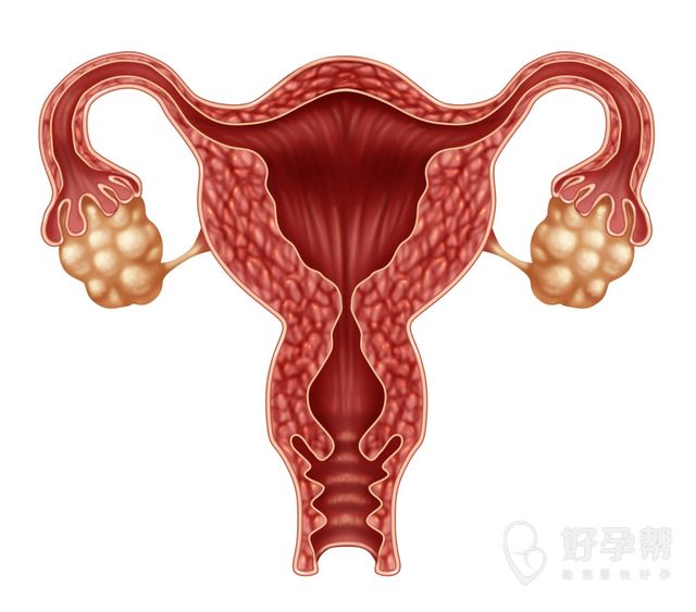 9厘米子宫肌瘤微创可以做吗？如何做治疗？