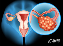 绝经后子宫内膜增厚是什么原因?为什么绝经期后会出现子宫内膜增厚?