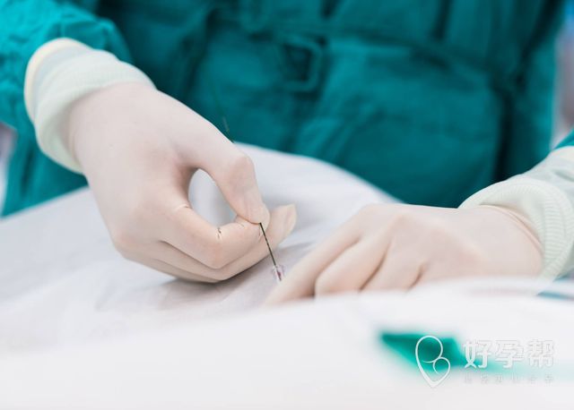 卵巢囊肿腹腔镜手术后要休息多久？手术后如何保养？