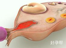 卵巢囊肿最怕什么食物？饮食要注意什么？