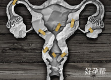 输卵管异常影响试管么？做试管还能不能够成功？