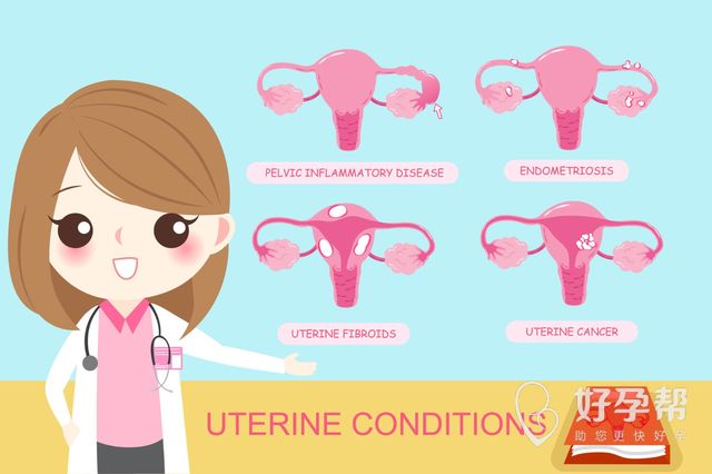 多囊卵巢能活多久？多囊卵巢有哪些危害？