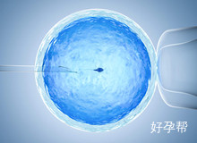 多囊卵巢做B超最佳时间是什么时候？多囊卵巢可以怀孕吗？