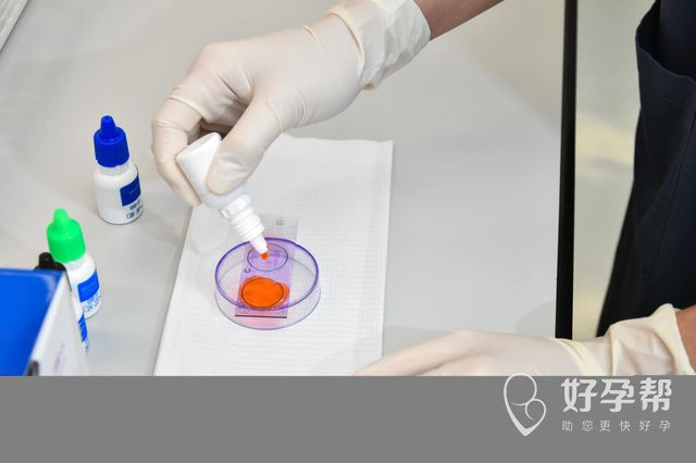 多囊卵巢可以做试管吗？多囊卵巢如何调理？