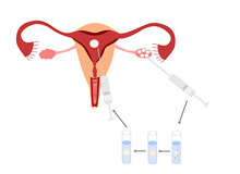 梅河口做宫腔镜多少钱？梅河口做宫腔镜贵不贵？