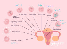 一侧多囊卵巢怀孕几率有多大？如何大幅提高怀孕概率？