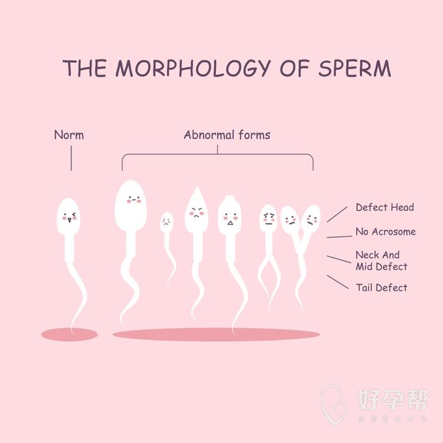 双侧多囊卵巢能怀孕吗？受孕的小妙招有哪些？