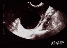 合肥哪个医院做试管婴儿技术好？什么办法可以提高试管成功率？