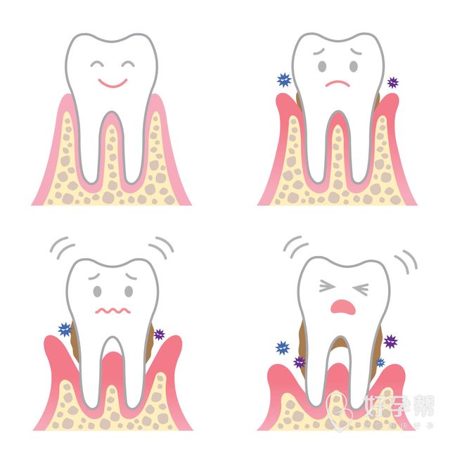 多囊卵巢会怀孕吗？怎样才能怀孕呢？