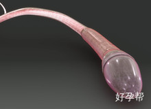 多囊卵巢可以怀孕吗？如何怀孕才最安全？