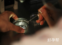 宫腔镜全麻后当月怀孕好吗？一定要全麻吗？