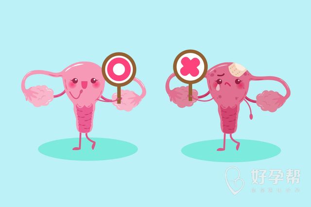 宫腔镜手术后容易怀孕？做了手术就可以怀孕？