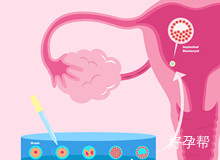 宫腔镜腹腔镜联合手术后怀孕几率大吗？怎样增加怀孕几率？