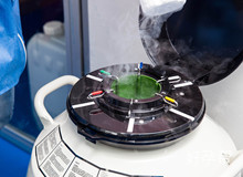 多囊备孕成功经验，注重健康饮食至关重要！