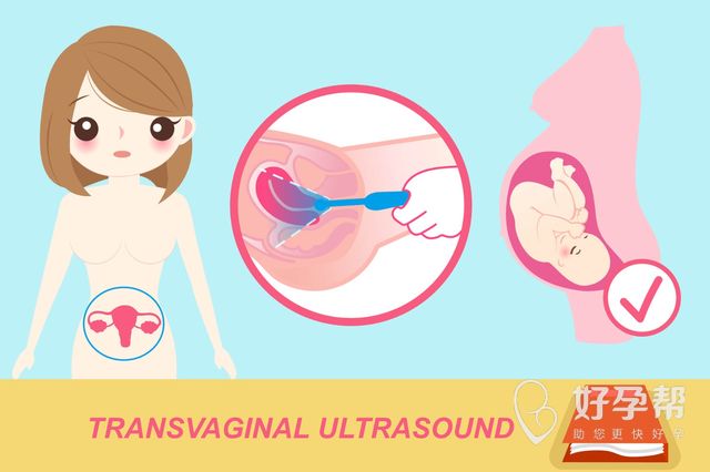 厦门174试管取卵疼吗？女性促排要注意什么？