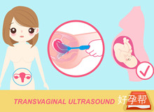 厦门174试管取卵有打麻醉吗？做好这些事成功率自然高！