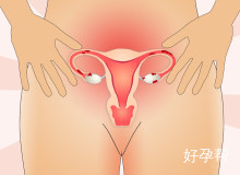 卵巢囊肿可以怀孕吗？囊肿治疗后会出现排卵障碍么？