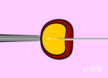 40岁以上试管几次成功？成功率取决于这些条件 看看你是否满足