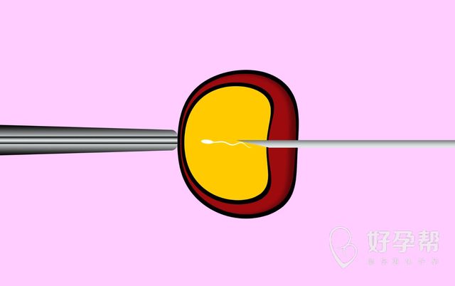 柳州试管婴儿包成功 试管婴儿如何才能成功？