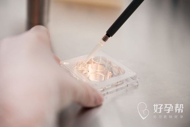 钦州妇幼做试管医生：做试管婴儿必须要满足这些条件