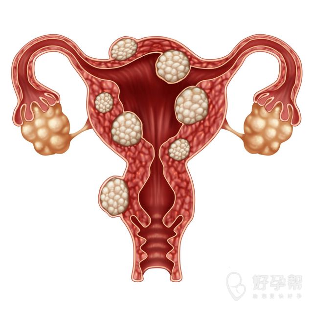 广西钦州试管婴儿补贴有吗？可以医保报销吗？