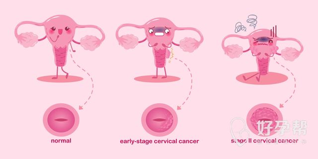 常德第一人民医院试管男女 你学会怎么鉴别了吗？
