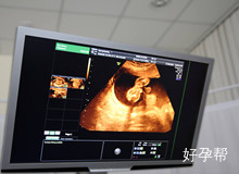 雅安试管婴儿医院的手术风险大吗?