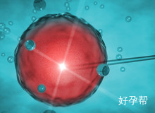 广西生殖中心试管婴儿排队 怎样才能避免排队?